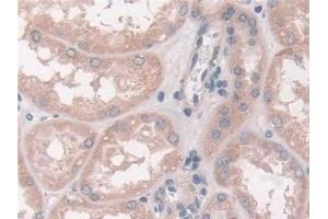 Immunohistochemistry (IHC) image for anti-Fucosyltransferase 6 (Alpha (1,3) Fucosyltransferase) (FUT6) (AA 35-359) antibody (ABIN7435952)