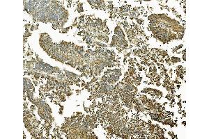 IHC analysis of MEK2/MAP2K2 using anti-MEK2/MAP2K2 antibody (ABIN7599357). (MEK2 Antikörper  (AA 1-400))