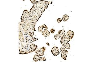 IHC analysis of SPHK1 using anti-SPHK1 antibody (ABIN7600168). (SPHK1 Antikörper  (AA 16-267))