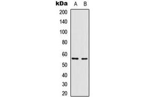 Western blot analysis of Vimentin expression in HepG2 (A), A549 (B) whole cell lysates. (Vimentin Antikörper  (N-Term))