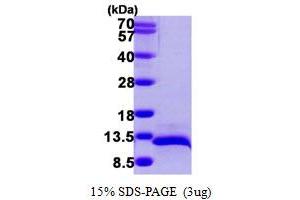 SDS-PAGE (SDS) image for Chemokine (C-C Motif) Ligand 14 (CCL14) (AA 20-93) protein (His tag) (ABIN667363)