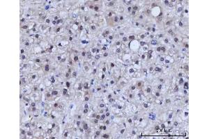 IHC analysis of RAD51C using anti-RAD51C antibody (ABIN7599718).
