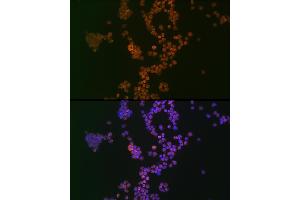 Immunofluorescence analysis of Jurkat cells using Ikaros Rabbit mAb (ABIN7267841) at dilution of 1:100 (40x lens). (IKZF1 Antikörper)
