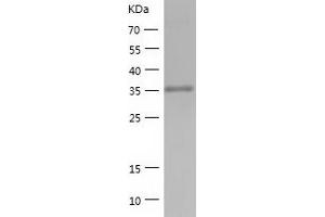 Western Blotting (WB) image for ADP-Ribosylarginine Hydrolase (ADPRH) (AA 1-357) protein (His tag) (ABIN7121730) (ADPRH Protein (AA 1-357) (His tag))
