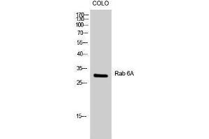 Western Blotting (WB) image for anti-RAB6A, Member RAS Oncogene Family (RAB6A) (Internal Region) antibody (ABIN3186630)
