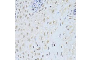 Immunohistochemistry of paraffin-embedded human esophagus using AIFM1 Antibody (ABIN5971393) at dilution of 1/200 (40x lens). (AIF Antikörper)