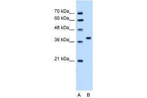 WB Suggested Anti-RUNDC2A Antibody Titration:  5.