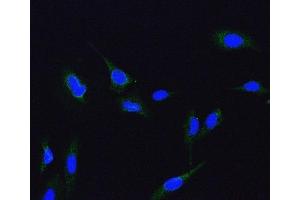 IF analysis of ME2 using anti-ME2 antibody (ABIN7600967). (NAD-ME Antikörper  (AA 26-584))