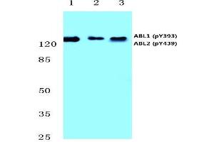 Western blot analysis of p-Abl1/2 antibody (pTyr393/439) Cat. (ABL1 Antikörper  (pTyr393, pTyr439))