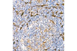 Immunohistochemistry of paraffin-embedded Human tonsil using Fascin/FSCN1 antibody (ABIN7267142) at dilution of 1:100 (40x lens). (Fascin Antikörper)