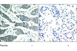 Image no. 1 for anti-V-Akt Murine Thymoma Viral Oncogene Homolog 1 (AKT1) (Tyr312), (Tyr315), (Tyr316) antibody (ABIN319374) (AKT1 Antikörper  (Tyr312, Tyr315, Tyr316))