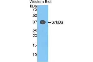 Detection of recombinant FBLN4 using Polyclonal Antibody to Fibulin 4 (FBLN4) (FBLN4 Antikörper  (AA 278-366))