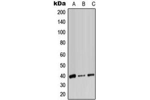 Western blot analysis of ADH7 expression in HeLa (A), SP2/0 (B), PC12 (C) whole cell lysates. (ADH7 Antikörper  (Center))