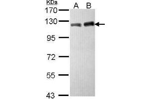 WB Image Sample (30 ug of whole cell lysate) A: Hela B: Hep G2 , 7.