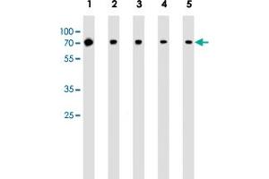 Western blot analysis of Lane 1: Jurkat whole cell lysates Lane 2: MCF-7 whole cell lysates Lane 3: K562 whole cell lysates Lane 4: A549 whole cell lysates Lane 5: mouse NIH/3T3 cell line lysates reacted with RPS6KB2 monoclonal antibody  at 1:1000 dilution. (RPS6KB2 Antikörper)