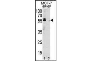 Western blot analysis of SQSTM1 Antibody  pre-incubated without (Lane 1) and with (Lane 2) blocking peptide in MCF-7 cell line lysate. (SQSTM1 Antikörper  (C-Term))