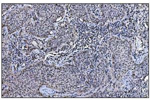 IHC analysis of JAB1 using anti-JAB1 antibody (ABIN7602482).