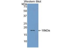 Western Blotting (WB) image for anti-Bone Morphogenetic Protein 15 (BMP15) (AA 269-391) antibody (ABIN1858148)