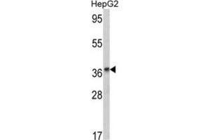 Western Blotting (WB) image for anti-Alcohol Dehydrogenase 1B (Class I), beta Polypeptide (ADH1B) antibody (ABIN3002782) (ADH1B Antikörper)