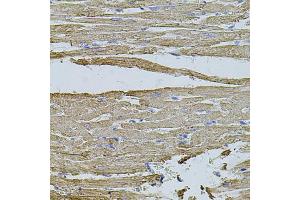 Immunohistochemistry of paraffin-embedded rat heart using HMMR antibody (ABIN5971368) at dilution of 1/100 (40x lens). (HMMR Antikörper)