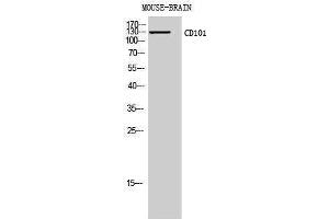 Western Blotting (WB) image for anti-CD101 (CD101) (Internal Region) antibody (ABIN3181441)