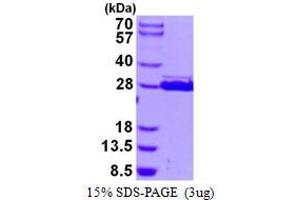 Image no. 1 for HscB Iron-Sulfur Cluster Co-Chaperone Homolog (HSCB) protein (His tag) (ABIN1098320)