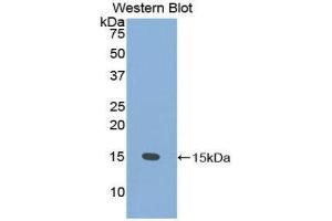 Western Blotting (WB) image for anti-Prostate Stem Cell Antigen (PSCA) (AA 22-95) antibody (ABIN1860333) (PSCA Antikörper  (AA 22-95))