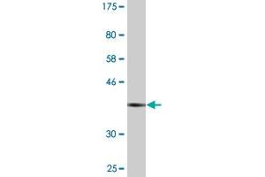 Western Blotting (WB) image for anti-Actin Related Protein 2/3 Complex, Subunit 5, 16kDa (ARPC5) (AA 3-94) antibody (ABIN523462)