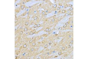Immunohistochemistry of paraffin-embedded mouse brain using HSP90 antibody (ABIN6134707, ABIN6142027, ABIN6142029 and ABIN6216078) at dilution of 1:200 (40x lens). (HSP90AA1 Antikörper)