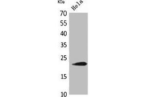 Western Blot analysis of HeLa cells using IFN- Polyclonal Antibody. (IFNW1 Antikörper  (C-Term))