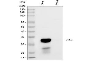 Western blot analysis of Cathepsin G/CTSG using anti-Cathepsin G/CTSG antibody (ABIN4886550). (Cathepsin G Antikörper  (AA 25-252))