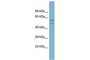 Image no. 1 for anti-ATPase, H+ Transporting, Lysosomal 56/58kDa, V1 Subunit B1 (ATP6V1B1) (AA 395-444) antibody (ABIN6744044) (ATP6V1B1 Antikörper  (AA 395-444))