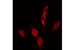 ABIN6276046 staining MCF7 by IF/ICC. (MC4R Antikörper  (C-Term))