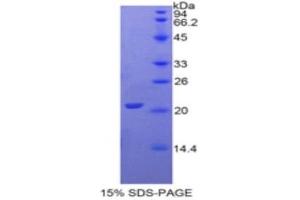 SDS-PAGE (SDS) image for gamma Glutamyltransferase 1 (GGT1) (AA 122-299) protein (His tag) (ABIN1079635) (GGT1 Protein (AA 122-299) (His tag))
