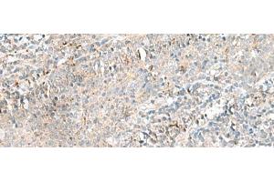 Immunohistochemistry of paraffin-embedded Human tonsil tissue using CTRB1 Polyclonal Antibody at dilution of 1:55(x200) (CTRB1 Antikörper)