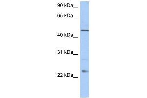 TMCO1 antibody used at 1 ug/ml to detect target protein.