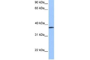WB Suggested Anti-UBA5 Antibody Titration:  0. (UBA5 Antikörper  (Middle Region))