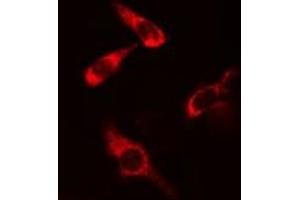 ABIN6277817 staining COLO205 cells by IF/ICC. (CARD11 Antikörper  (Internal Region))