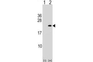 Western Blotting (WB) image for anti-phospholipase A2, Group XIIA (PLA2G12A) antibody (ABIN2998884) (PLA2G12A Antikörper)