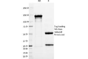 SDS-PAGE (SDS) image for anti-Ubiquitin Carboxyl-terminal Esterase L1 (Ubiquitin Thiolesterase) (UCHL1) antibody (ABIN6940852)