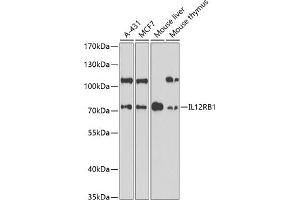 Western blot analysis of extracts of various cell lines, using IL12RB1 antibody (ABIN6132305, ABIN6142300, ABIN6142302 and ABIN6219020) at 1:1000 dilution. (IL12RB1 Antikörper  (AA 25-305))