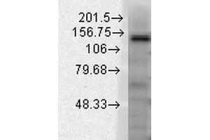 Western Blot analysis of Rat brain membrane lysate showing detection of Slo2. (KCNT1 Antikörper  (AA 1168-1237) (PE))