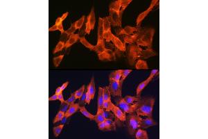 Immunofluorescence analysis of C6 cells using JNK1/JNK3 Rabbit mAb (ABIN1678909, ABIN7101754, ABIN7101755 and ABIN7101756) at dilution of 1:100 (40x lens). (JNK Antikörper)