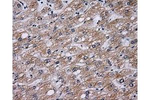 Immunohistochemical staining of paraffin-embedded liver tissue using anti-BTK mouse monoclonal antibody. (BTK Antikörper)