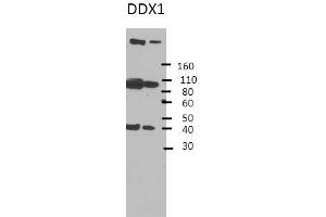 Western Blotting (WB) image for anti-DEAD (Asp-Glu-Ala-Asp) Box Polypeptide 1 (DDX1) (Middle Region) antibody (ABIN2775202)