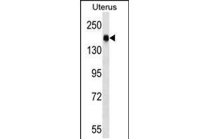 Western blot analysis in human normal Uterus tissue lysates (35ug/lane). (CGNL1 Antikörper  (N-Term))