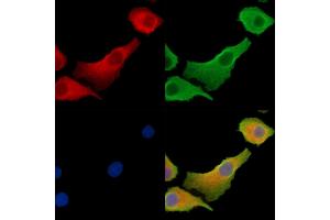 ABIN7095402 and ABIN7099459 staining Hela cells by IF/ICC. (Calsyntenin 2 Antikörper)