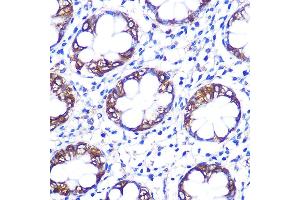 Immunohistochemistry of paraffin-embedded rat testis using Serotonin transporter Rabbit pAb (ABIN7270477) at dilution of 1:100 (40x lens). (SLC6A4 Antikörper  (C-Term))