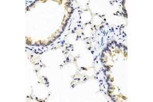 Immunohistochemistry of paraffin-embedded rat lung using IFNL1 antibody at dilution of 1:100 (40x lens). (IL29 Antikörper)