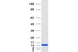Western Blotting (WB) image for S100 Calcium Binding Protein A9 (S100A9) protein (Myc-DYKDDDDK Tag) (ABIN2731328)